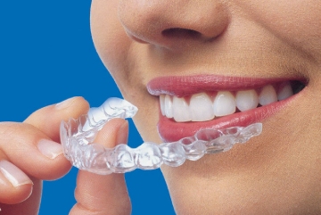 Invisalign
